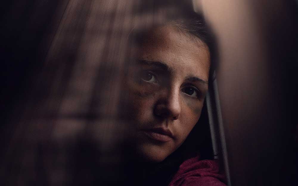 Frau mit Bluterguss unter den Augen sieht aus dem Fenster
